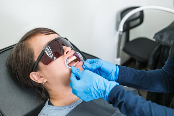 Best Knocked-Out Tooth (Avulsed Tooth) Treatment in Canterwood, WA