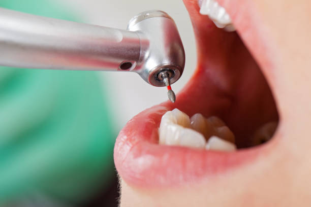 Best Walk-In Emergency Dental Services in Canterwood, WA